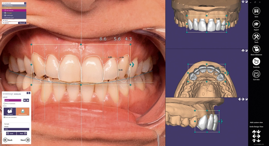 ChairsideCAD Smile Creator Module