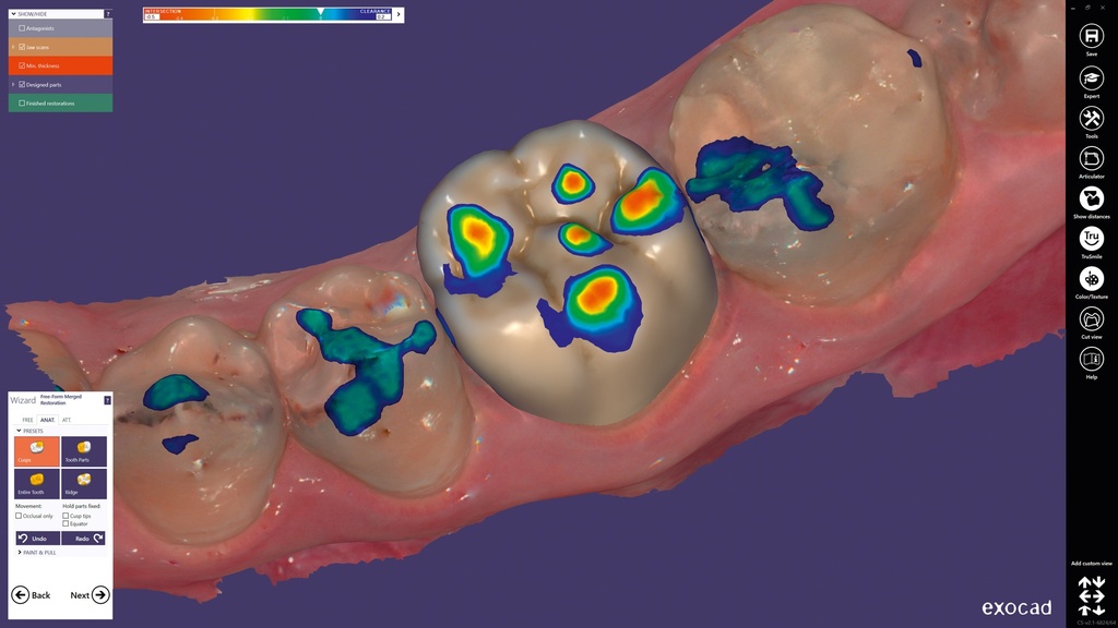 ChairsideCAD Auto Articulator Module