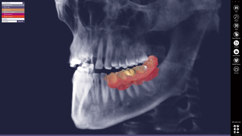 ChairsideCAD DICOM Viewer Module