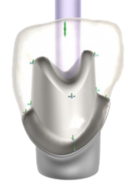Exocad Implant Module Flex Licentie
