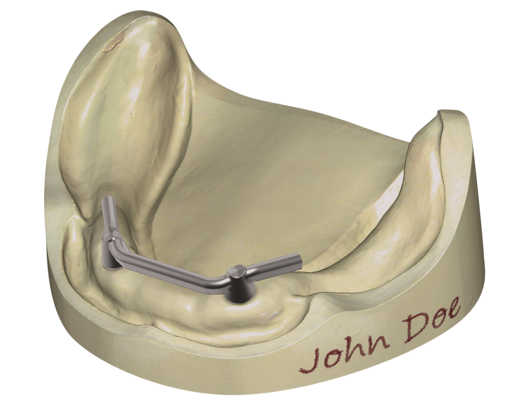 Exocad Bar Module Perpetual