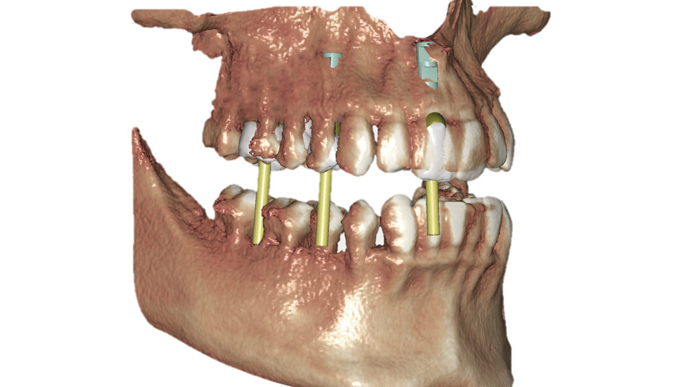 Exocad DICOM viewer Module Flex Licentie