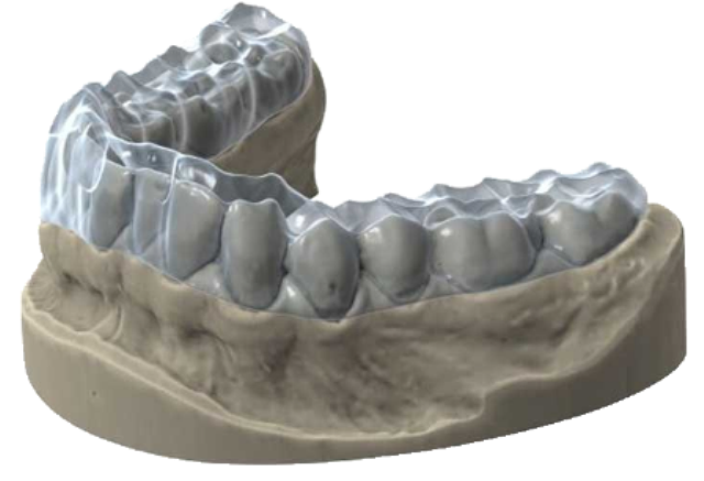 Exocad Bite Splint Module Perpetual