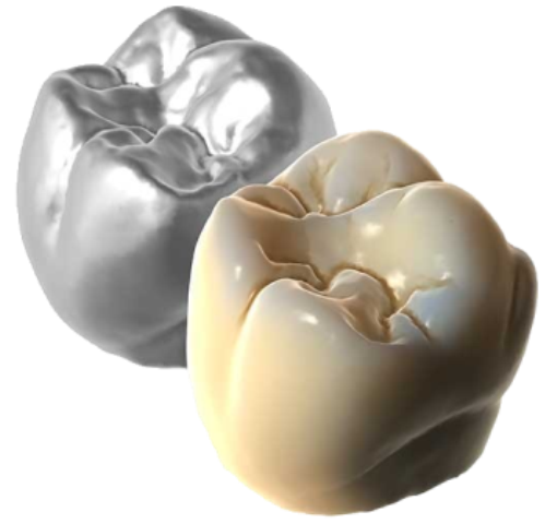 Exocad TruSmile Module Perpetual