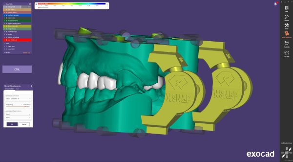 Exocad xSnap for Module Creator Stand Alone