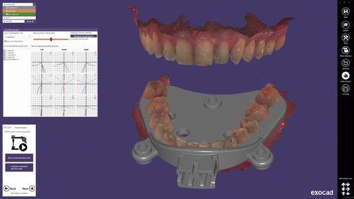 [SW-CC-12] ChairsideCAD Jaw Motion Import Module
