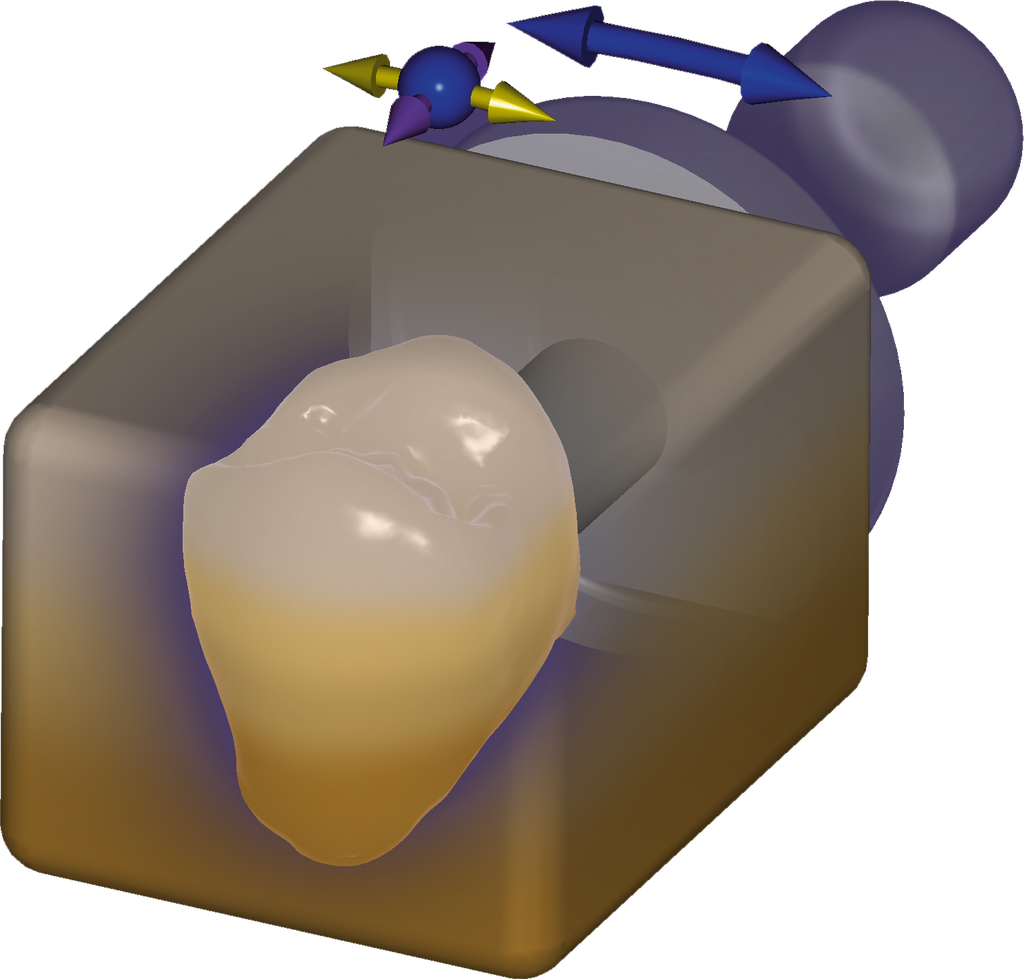 [SW-CC-17] ChairsideCAD in-CAD Nesting Module