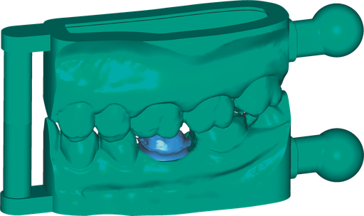 [SW-CC-5] ChairsideCAD Model Creator Module