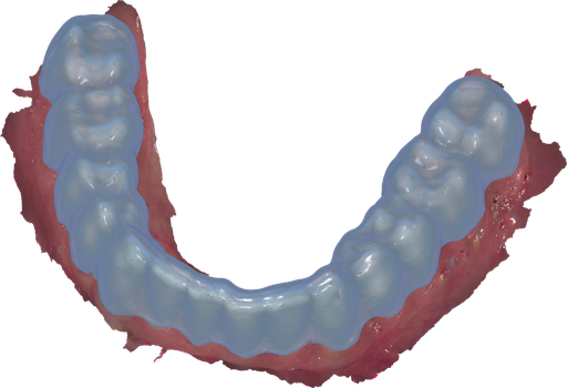 [SW-CC-7] ChairsideCAD Bite Splint Module