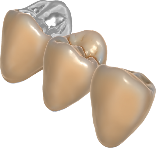 [SW-CC-8] ChairsideCAD TruSmile Module