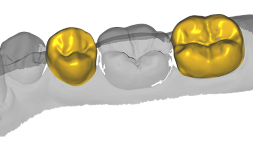 [SW-EC-10-FL] Exocad Provisional Module Flex Licentie
