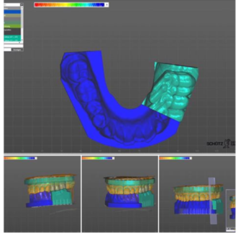 [SW-EC-12-FL] Exocad Jaw Motion Import Flex Licentie