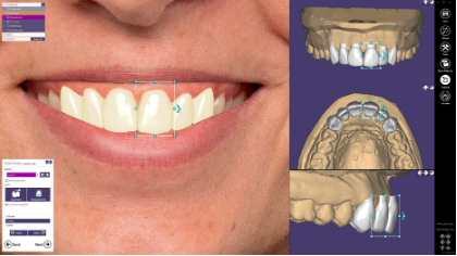 [SW-EC-16-SA] Exocad Smile Creator Module Stand Alone