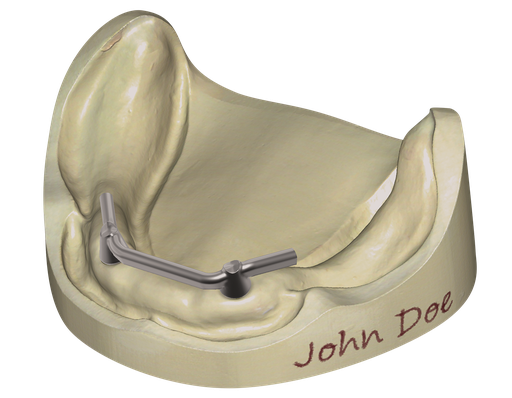 [SW-EC-4-FL] Exocad Bar Module Flex Licentie