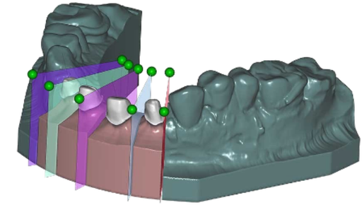 [SW-EC-5-FL] Exocad Model Creator Module Flex Licentie