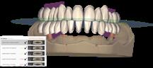 [SW-EC-25-FL] Exocad Inspira™ Denture Tooth Library Flex